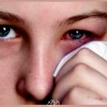  حساسية العين الأسباب والعلاج