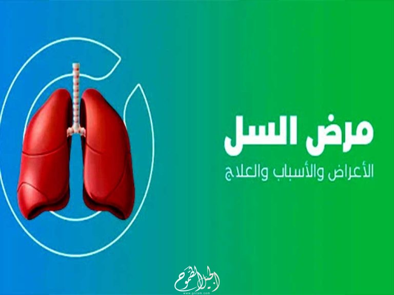 معلومات عن مرض السل