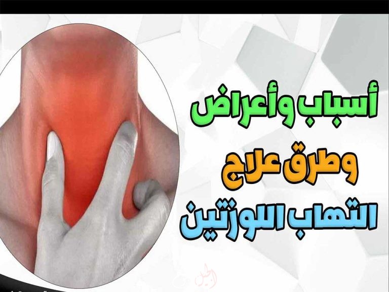 أسباب وعلاج التهاب اللوزتين